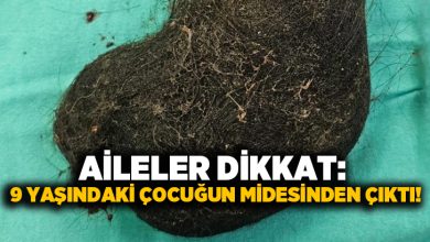 Aileler dikkat: 9 yaşındaki çocuğun midesinden çıktı!