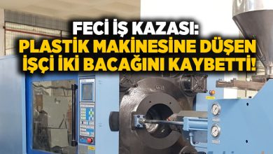 Feci iş kazası: Plastik makinesine düşen işçi iki bacağını kaybetti!