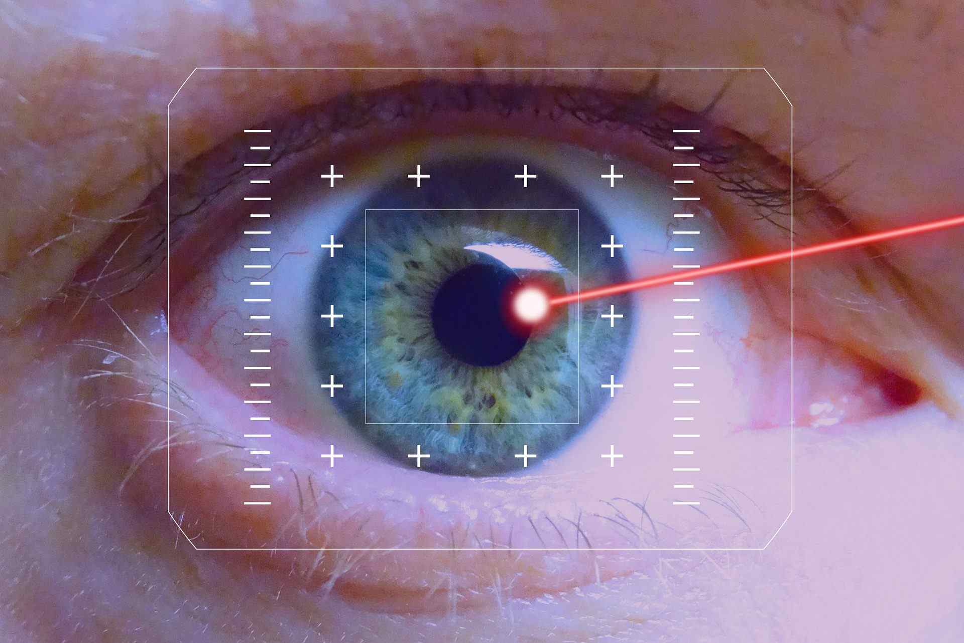 Göz çizdirme ameliyatı nasıl yapılır? 2022 göz çizdirme ücretleri