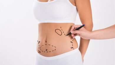 Liposuction ve Estetik Yöntemleri Nelerdir?