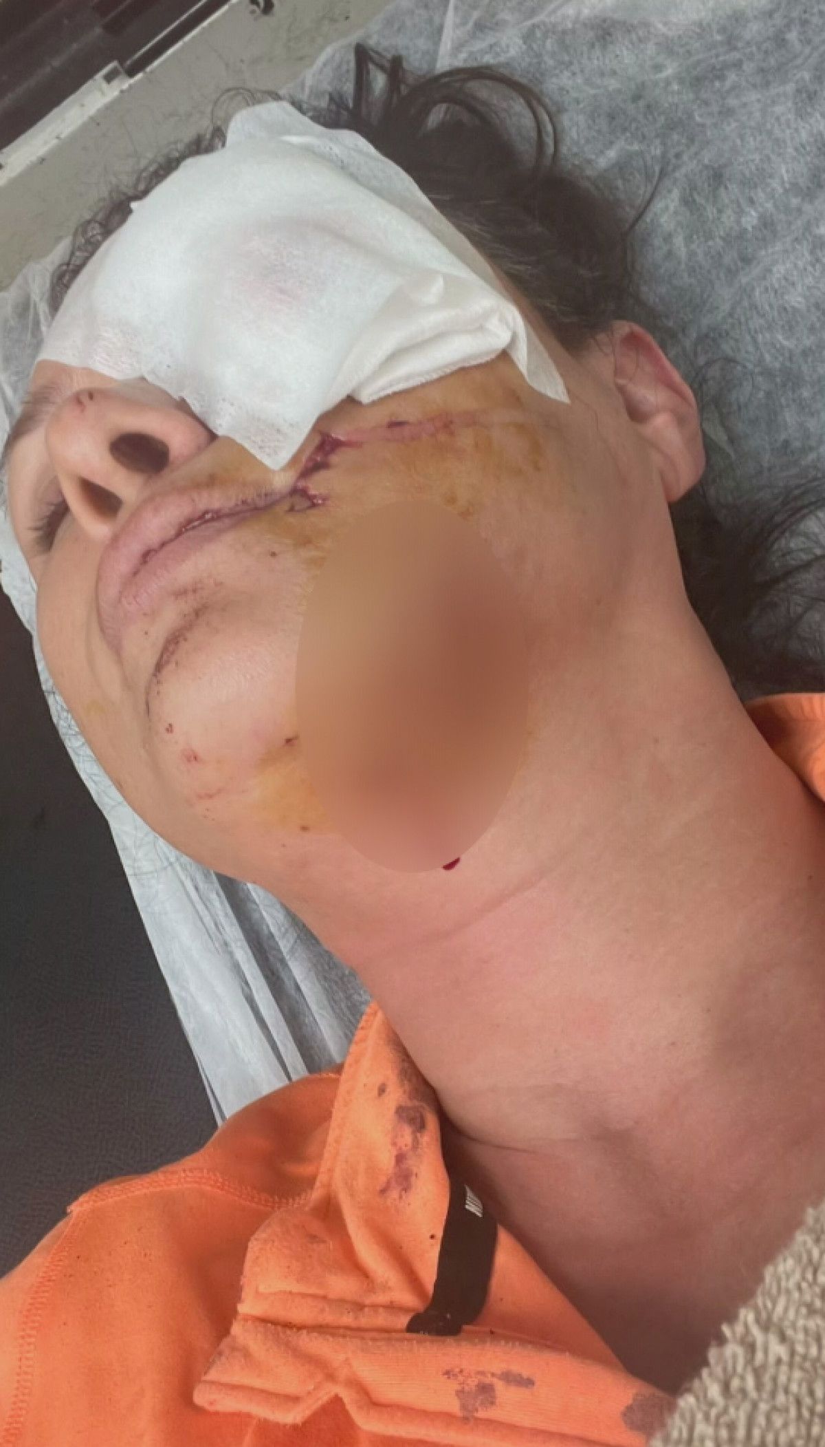 Köpek saldırısına uğrayan Tuğba Altıntop yüzünden yaralandı #3