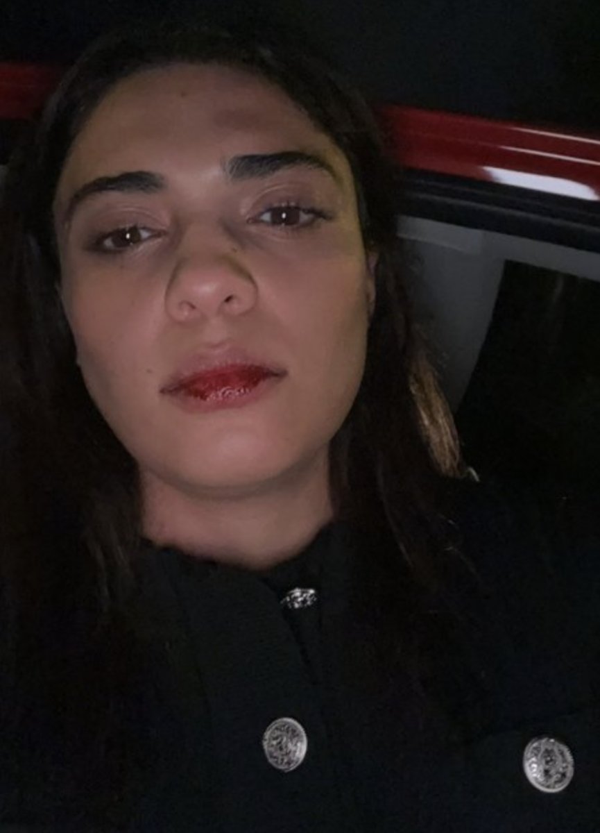 Azerbaycanlı şarkıcı Bagieva, İstanbul da taksici saldırısına uğradı #2