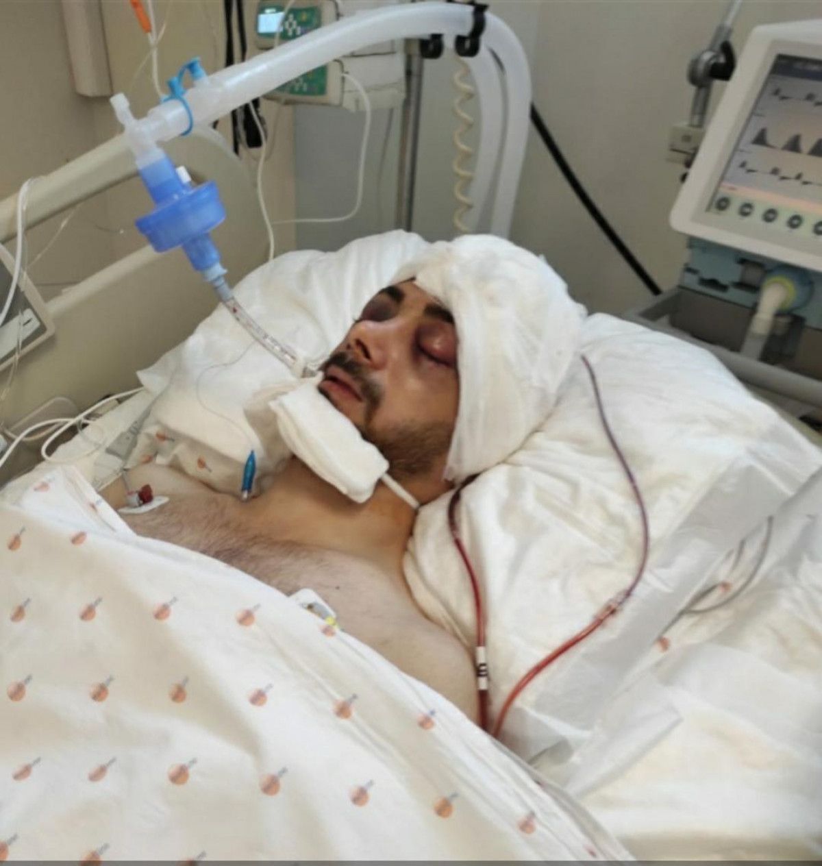Adana da 41 gün komada kalan jokey Samet, 18 ay sonra ata bindi #7