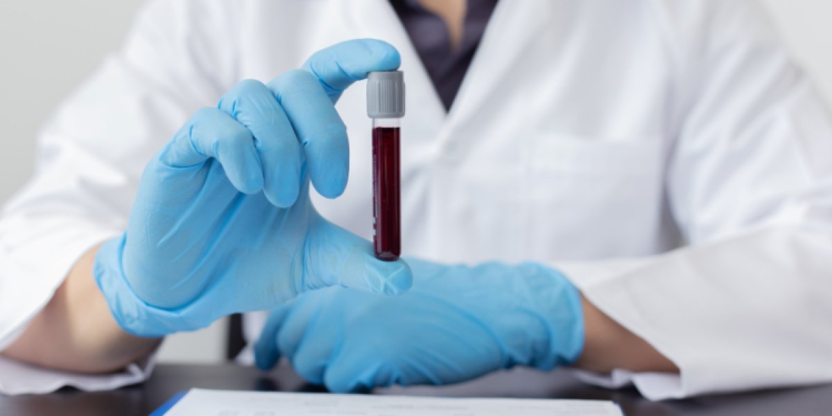 Laboratuvar kanı ilk kez bir insana nakledildi #2